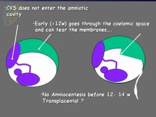 Dépistage des anomalies chromosomiques : différentes méthologies de caryotypes
