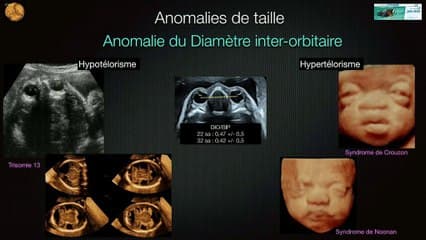 oeil et orbite* Imagerie