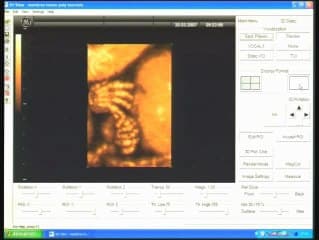 Démonstrations 3D à partir de volumes et d’un examen sur patiente Face