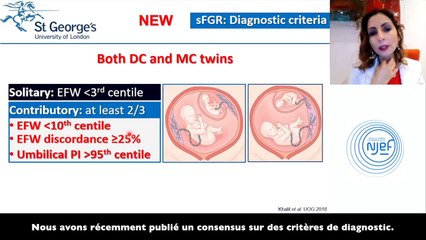 GROSSESSES GEMELLAIRES: Pour une meilleure gestion échographique VO