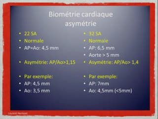 Anomalies du pédicule artériel, déséquilibres des cavités cardiaques, anomalies de la fonction ventriculaire