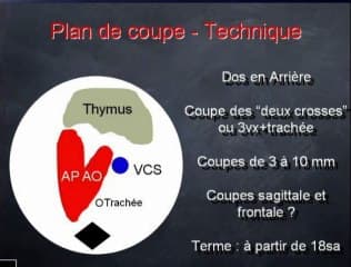 Thymus : techniques volumiques