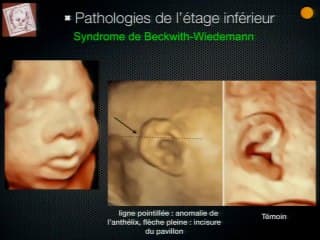 Les techniques d'imagerie et la dysmorphologie faciale objective