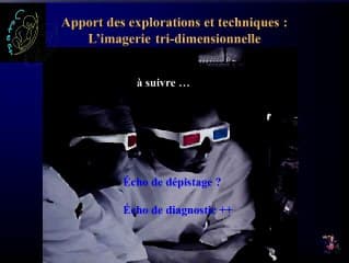 3D et cerveau foetal : apports en pratique clinique