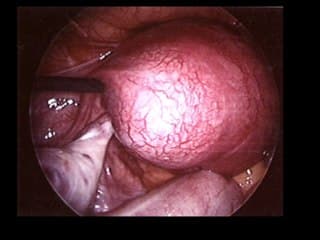 Urgences en debut de grossesse ? Les images à connaître absolument !