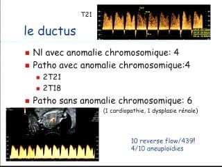 Second stage screening de la trisomie 21, 18 mois d'expérience strasbourgeoise