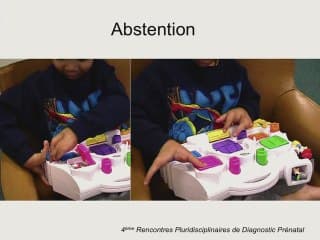 Membres courts, déformés, absents : traitement et pronostic.