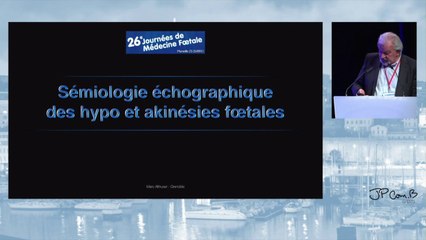 Sémiologie échographique des hypo et akinésies fœtales