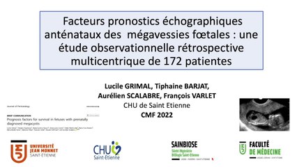 Facteurs pronostics échographiques anténataux des mégavessies foetales : une étude observationnelle rétrospective multicentrique de 174 patientes
