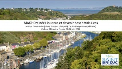 MAKP Drainées in utero et devenir post natal : 4 cas