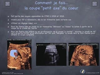 POSTER Gros Vx Petit axe