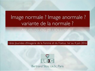 L'examen du coeur aujourd'hui Image normale ? Image pas normale ? Les variants de la normale