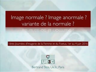 L'examen du coeur aujourd'hui Image normale ? Image pas normale ? Les variants de la normale