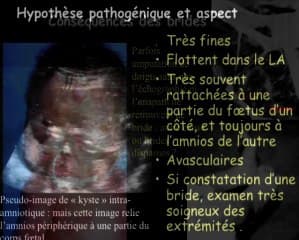 Les images placentaires inhabituelles