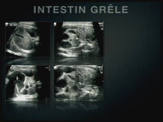 Tube digestif et haute fréquence.