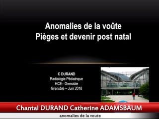 Anomalies de la voute : pièges et devenir post natal