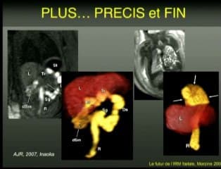 IRM digestive