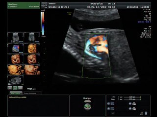 demo live coeur ( en ANGLAIS )