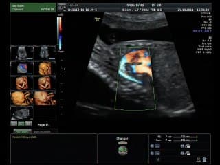 demo live coeur ( en ANGLAIS )