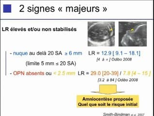 Échographie du 2ème trimestre : valeur des petits signes statistiques pour les nuls ou comment faire un calcul de risque intégré ? Vous avez dit genetic scan ?
