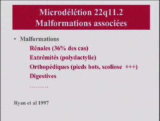 Qu’est-ce que le syndrome de Di George ?
