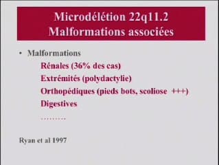 Qu’est-ce que le syndrome de Di George ?