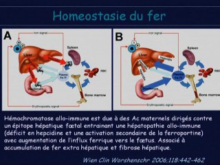 Anomalies du signal hépatique foetal.