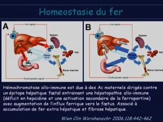 Anomalies du signal hépatique foetal.