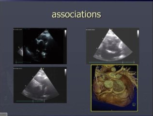 Les dossiers des cardio-pédiatres : des signes d’appel à l’analyse des images