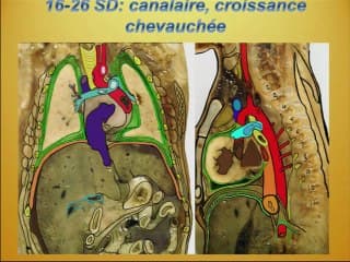 La formation du poumon foetal : principales étapes et pathologies