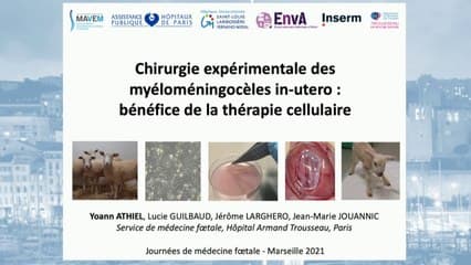 Les avancés de la chirurgie expérimentale des MyéloMéningoCèle sur la brebis.