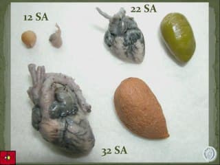 L'annonce de la malformation cardiaque : un coup au coeur ?