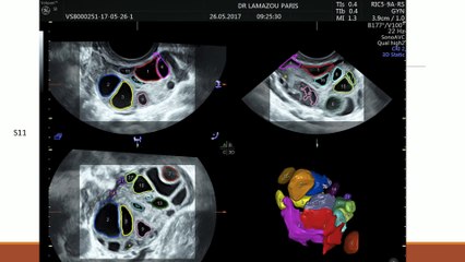 Monitorage de l'ovulation Live on demand