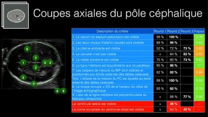 Les silhouettes de la CNEOF