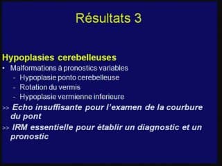 anomalies de la FPC et du cervelet