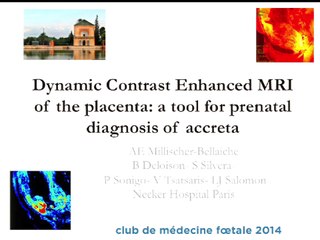 L'intér't de la perfusion de gadolinium en IRM, en cas de suspicion de placenta accreta.