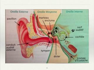 Oreilles :  Anomalies de forme et de position, canaux semi-circulaires