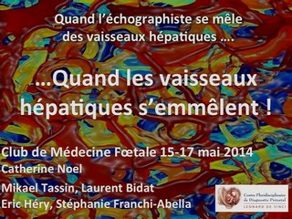 Quand les vaisseaux hépatiques s'emm'lent.