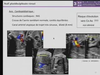 Image échogéne pulmonaire