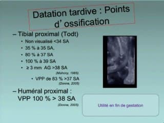 Datation de la grossesse : pas si simple !