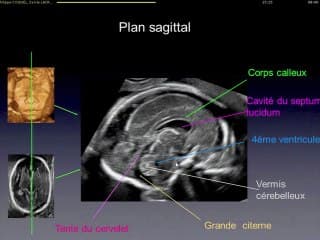 Le cerveau : de la mesure au diagnostic Que mesurer, comment mesurer ?