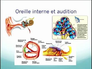 CMV : Séquelles auditives