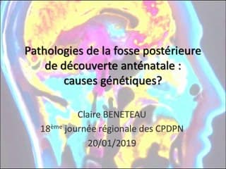 Pathologie de la fosse postérieure de découverte anténatale : causes génétiques ?