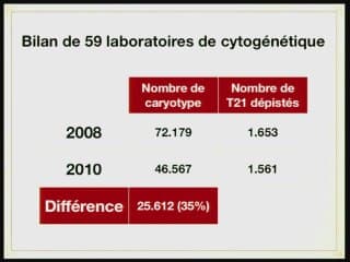 Bilan des nouvelles stratégies du dépistage de la Trisomie 21.