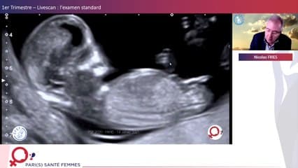 1er Trimestre: Examen standart