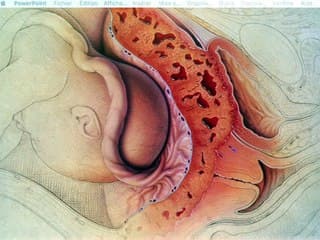 Le placenta dans tous ses etats