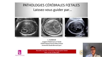 Espaces péri-cérébraux