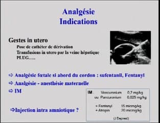 La douleur et l’analgésie chez le foetus