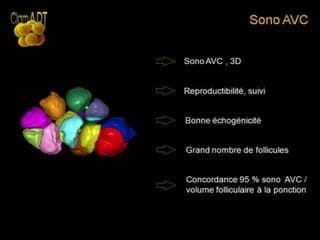 Monitorage de l'ovulation  LES FOLLICULES que doit-on rechercher ?