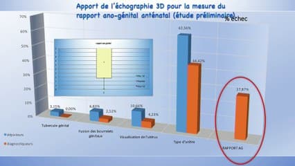 Apport de l’échographie 3D pour la mesure du rapport ano-génital anténatal (étude préliminaire).